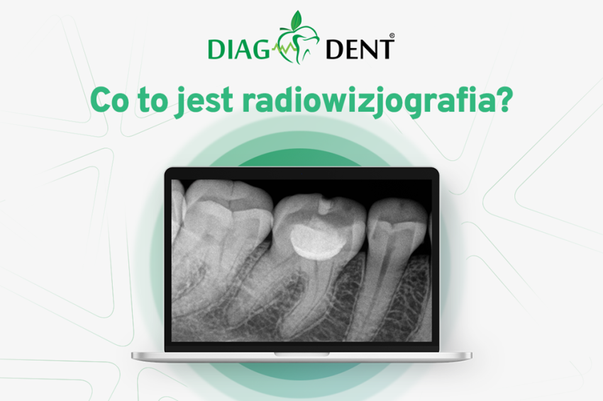 Co to jest radiowizjografia?
