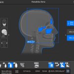 Tomografia CBCT zatok